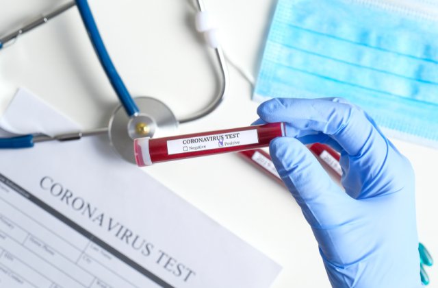 Bilanțul Covid-19 &icirc;n Rom&acirc;nia: 450 de cazuri noi și 20 de decese &icirc;n ultimele 24 de ore