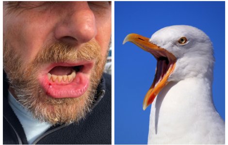 Bărbat rănit după ce a fost atacat de un pescăruș ce a vrut să-i fure sandvișul