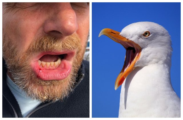 Bărbat rănit după ce a fost atacat de un pescăruș ce a vrut să-i fure sandvișul