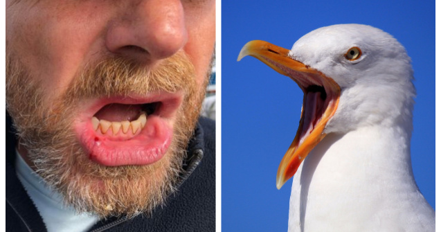 Bărbat rănit după ce a fost atacat de un pescăruș ce a vrut să-i fure sandvișul