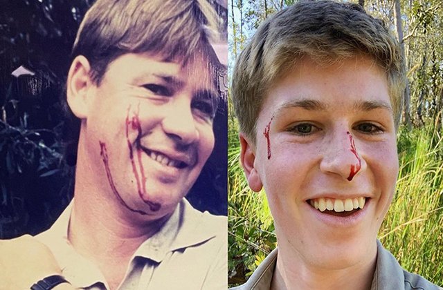 FOTO Fiul lui Steve Irwin a fost mușcat de un șarpe. Ce a făcut câteva ore mai târziu