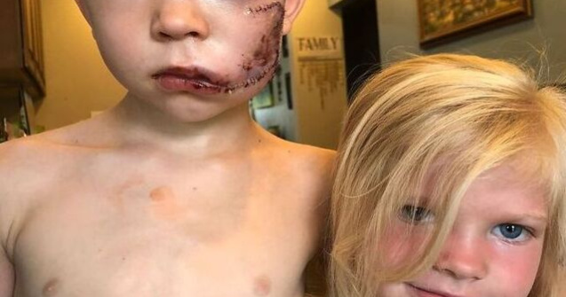 Supererou la doar 6 ani! Și-a salvat sora mai mică de un câine agresiv