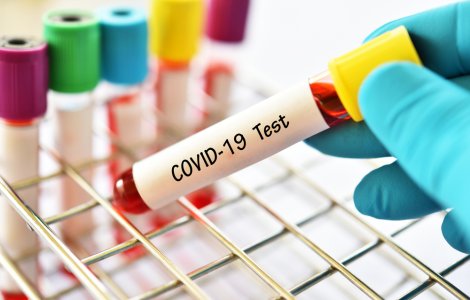 Bilanțul Covid-19 în România: 1.136 de cazuri noi, din 20.552 teste efectuate
