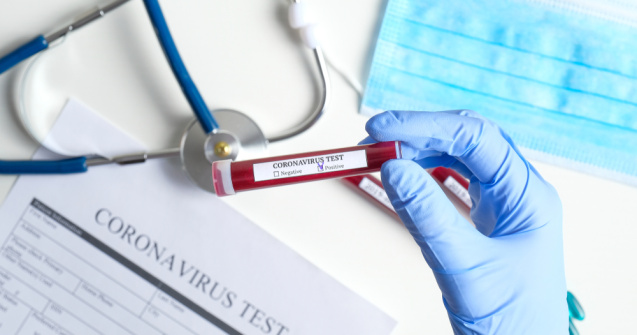 Bilanț Covid-19 în România: 1.380 cazuri noi de infectare și 47 de decese