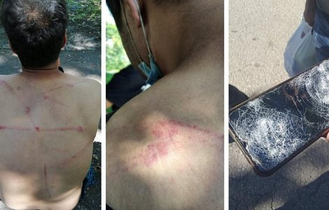 Polițiștii de frontieră din România, acuzați că îi bat și electrocutează pe refugiații care ajung la graniță