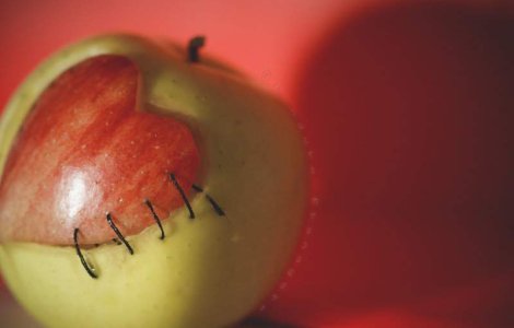 In Romania nu se mai fac transplanturi de cord de doi ani