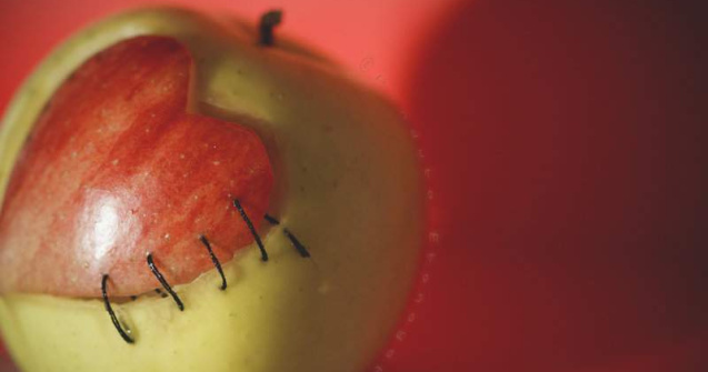 In Romania nu se mai fac transplanturi de cord de doi ani