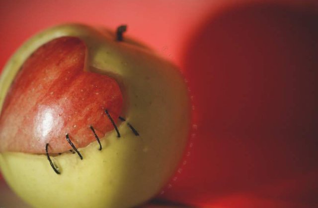 Sute de vieti in pericol pentru ca in Romania nu se mai fac transplanturi de cord