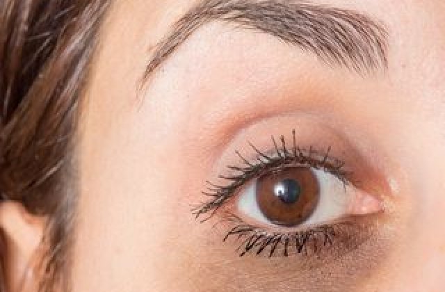 Cearcănele de sub ochi, o problemă estetică. Cum putem scăpa de acestea și care pot fi reacțiile adverse