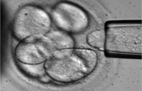 2 mii de romani, inscrisi pentru a dona celule stem