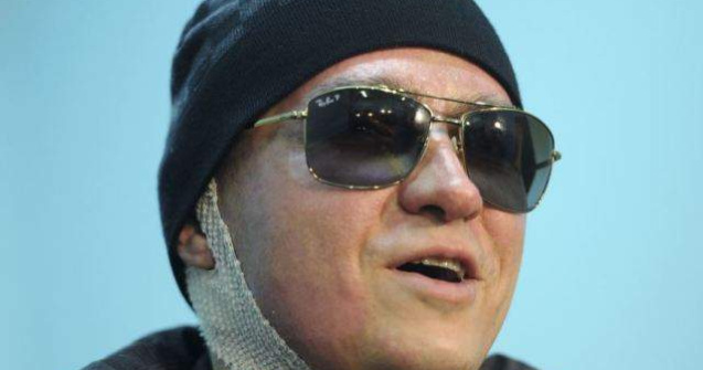 Directorul artistic al Teatrului Balsoi, atacat cu acid, si-a pierdut vederea