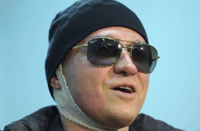 Directorul artistic al Teatrului Balsoi, atacat cu acid, si-a pierdut vederea