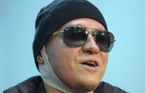 Directorul artistic al Teatrului Balsoi, atacat cu acid, si-a pierdut vederea