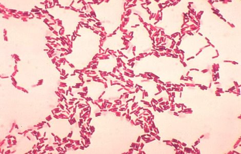 Alerta de antrax la Iasi: Un barbat este suspectat ca poarta bacteria ucigasa