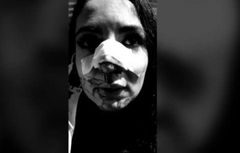 Cristina Joia a fost bătută şi desfigurată într-un magazin din Capitală