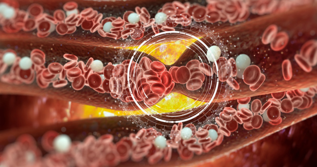  Top  10 moduri de a preveni cheagurile de sânge care ne pot pune viața în pericol