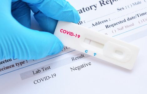 Prețul testelor COVID-19 diferă în funcție de clinică