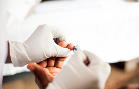 Asociaţia Română Anti-SIDA organizează o campanie pentru testarea HIV gratuită