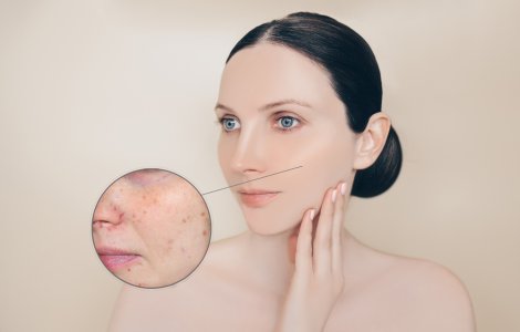  Top  5 obiceiuri pentru îngrijirea pielii care îți fac rău