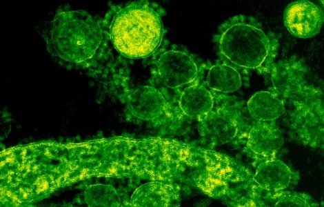 Coronavirus nu si-a facut inca aparitia in Romania