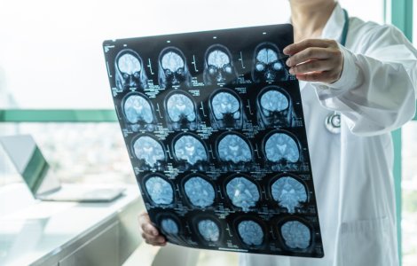 Accidente vasculare cerebrale - cauze și persoanele predispuse. Medic: „Atenţie la ce şi cât mâncaţi de sărbători!”