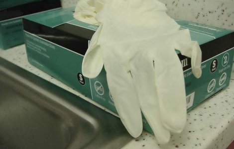 S-a indepartat o tumoare de la articulatia cotului, in premiera