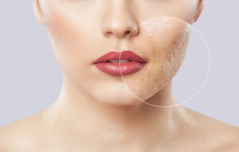  Top  Ai grijă de tenul tău! 3 tratamente naturale care te scapă de petele de pe faţă