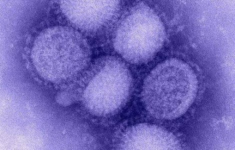 Alte doua decese in randul pacientilor cu A/H1N1 din Romania