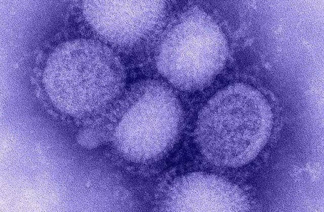 Alte doua decese in randul pacientilor cu A/H1N1 din Romania