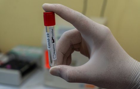 Alte 10 cazuri de infectare cu noua tulpină de Covid-19, depistate în România