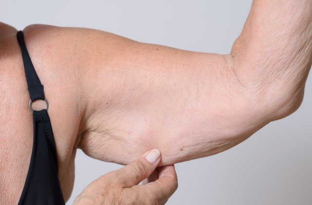 Ai grijă de aspectul tău! 4 moduri prin care poți elimina pielea lăsată după ce ai slăbit