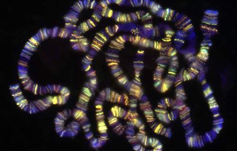 Cercetatorii americani au descoperit un posibil antidot pentru cancerul de prostata