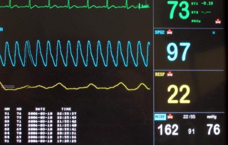 Accidentul din Muntenegru: O femeie declarata moarta traieste