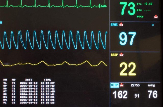 Accidentul din Muntenegru: O femeie declarata moarta traieste