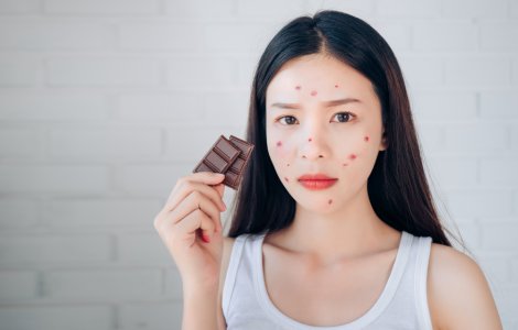  Top  Evită apariția coșurilor: 3 alimente care pot provoca acnee