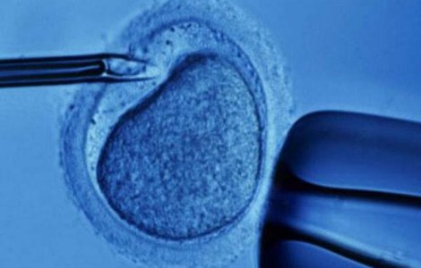 Un tip de fecundare in vitro poate provoca retard mintal