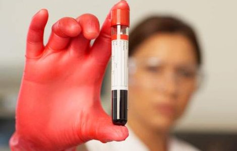 Soferii, obligati sa plateasca testele antidrog pentru permis