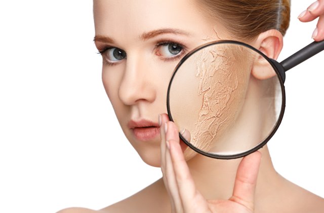 Piele uscată și acnee: Primele semne care apar când ai deficiențe în nutriție