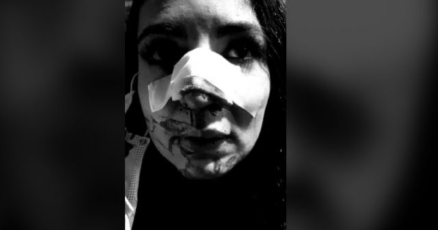 FOTO Cristina Joia, prima apariție după operațiile suferite în urma agresiunii