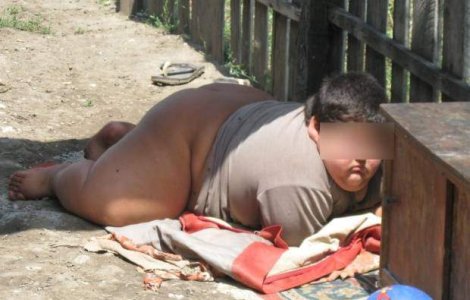 Alexandru, copilul de 120 de kilograme din Dragotesti, a murit