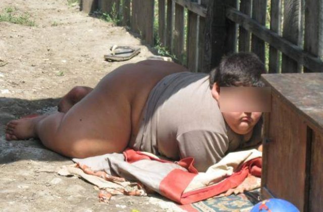 Alexandru, copilul de 120 de kilograme din Dragotesti, a murit