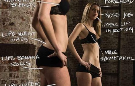 Top vedete cu operatii estetice