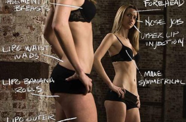 Top vedete cu operatii estetice