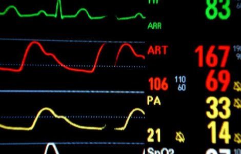Senzatiile resimtite in timpul mortii clinice, explicate de cercetatori
