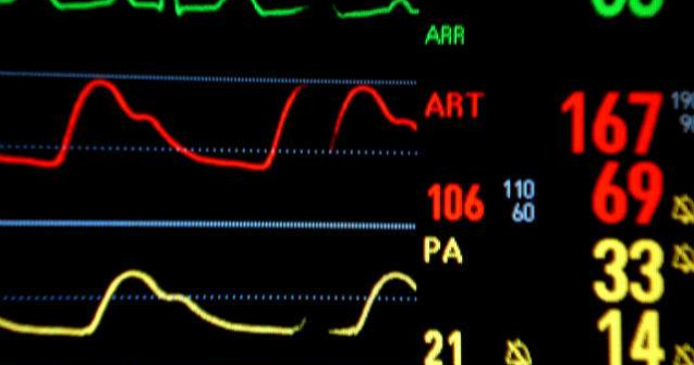 Senzatiile resimtite in timpul mortii clinice, explicate de cercetator