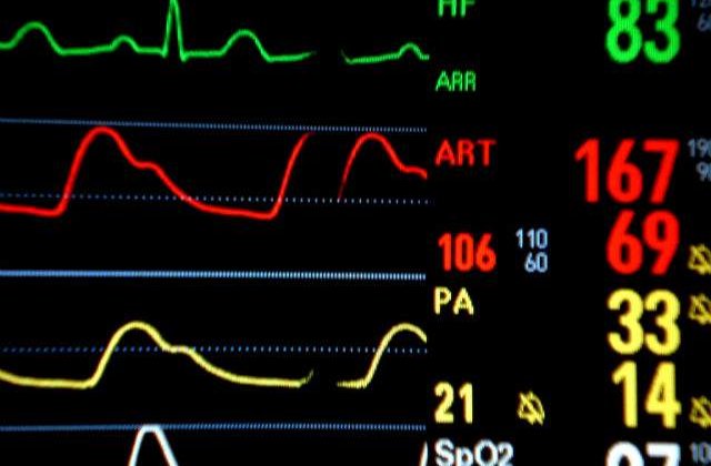Senzatiile resimtite in timpul mortii clinice, explicate de cercetatori