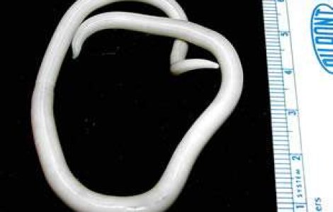 Cura de slabire cu viermi paraziti