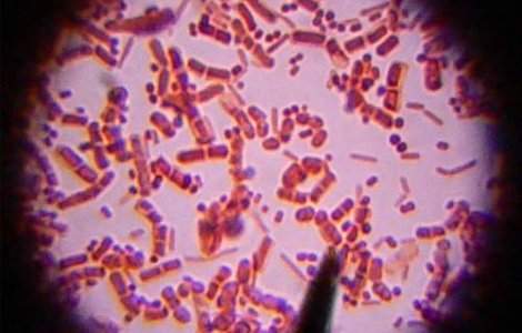 O bacterie carnivora aproape a ucis un om
