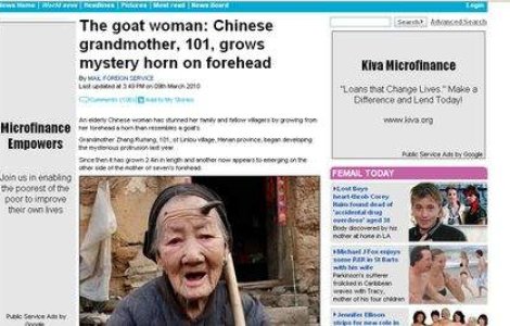 Unei femei din China i-a crescut un corn in cap