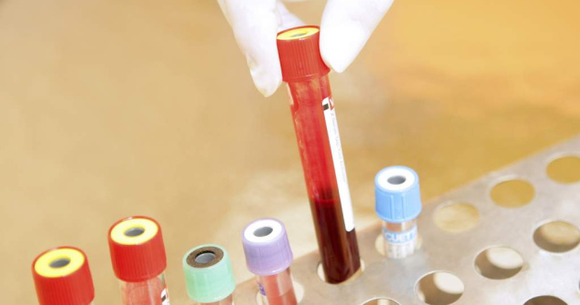 BBC: In Romania se gasesc ultimii leprosi din Europa